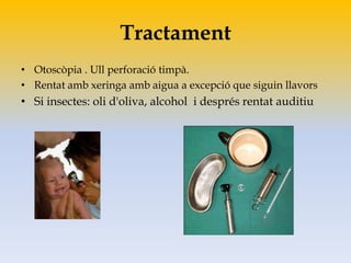 Tractament
• Otoscòpia . Ull perforació timpà.
• Rentat amb xeringa amb aigua a excepció que siguin llavors
• Si insectes: oli d'oliva, alcohol i després rentat auditiu
 