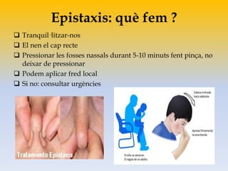 Epistaxis: què fem ?
 Tranquil·litzar-nos
 El nen el cap recte
 Pressionar les fosses nassals durant 5-10 minuts fent pinça, no
deixar de pressionar
 Podem aplicar fred local
 Si no: consultar urgències
 