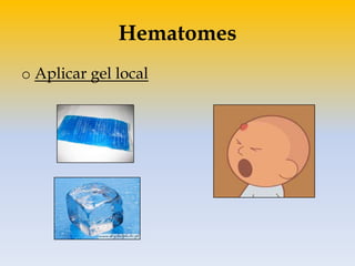 Hematomes
o Aplicar gel local
 