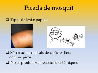 Picada de mosquit
 Tipus de lesió: pàpula
 Són reaccions locals de caràcter lleu:
edema, picor
 No es produeixen reaccions sistèmiques
 