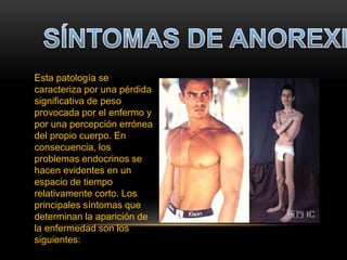 Esta patología se
caracteriza por una pérdida
significativa de peso
provocada por el enfermo y
por una percepción errónea
del propio cuerpo. En
consecuencia, los
problemas endocrinos se
hacen evidentes en un
espacio de tiempo
relativamente corto. Los
principales síntomas que
determinan la aparición de
la enfermedad son los
siguientes:
 