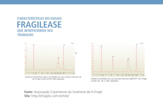 Análise de eletroforese capilar microfluídica de uma amostra masculina de
NA09237
de X frágil Coriell com931-940 repetições. Análise microfluídica de uma amostra feminina NA07537 de X frágil
Coriell com 28 e 336 repetições
 