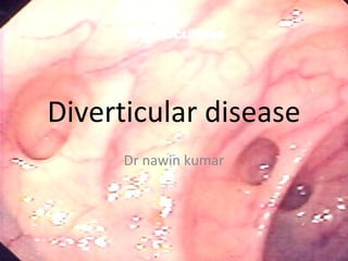 Diverticular disease
Dr nawin kumar
 