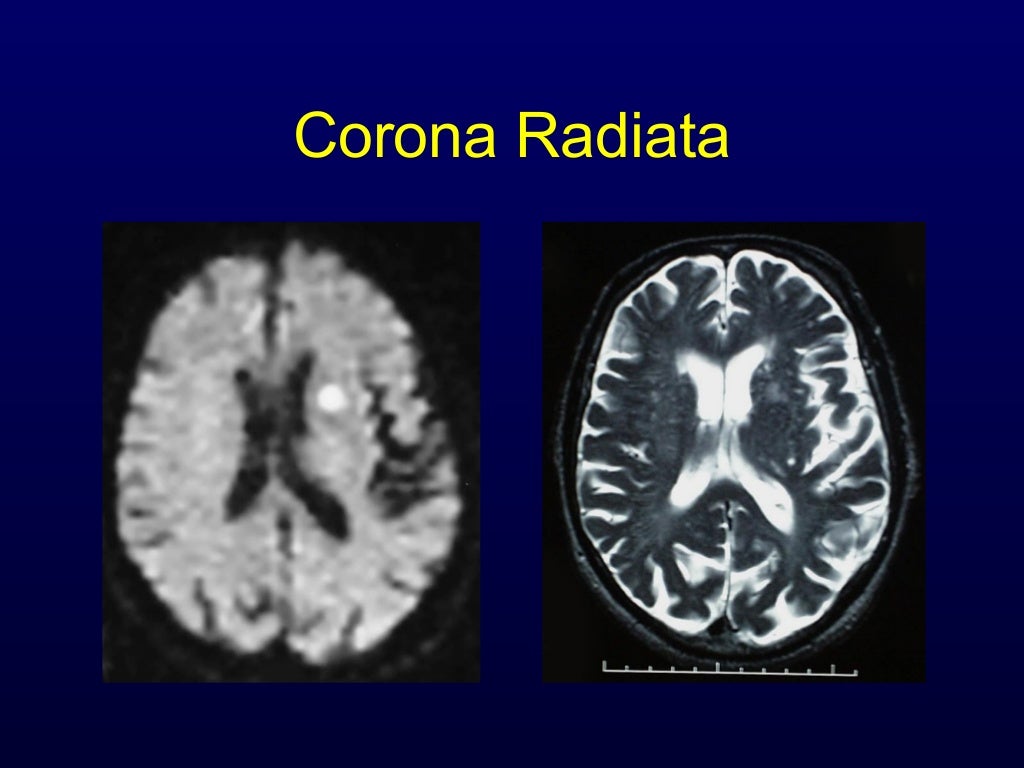 Anatomy of Motor system2