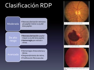 Clasificación RDP
• Neovascularización retiniana
y/o papilar menor a 1/3 del
área papilar.
Moderada
• Neovascularización papilar
mayor a 1/3 del área papilar.
• Hemorragia pre retinal o
vítrea.
De alto
riesgo
• Hemorragia vítrea extensa y
densa.
• Desprendimiento de retina.
• Proliferación fibrovascular.
Avanzada
 