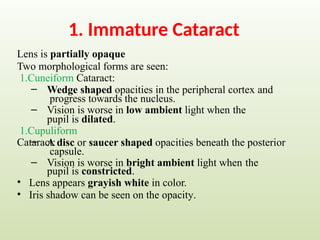 1. Immature Cataract
Lens is partially opaque
Two morphological forms are seen:
1.Cuneiform Cataract:
–
–
Wedge shaped opacities in the peripheral cortex and
progress towards the nucleus.
Vision is worse in low ambient light when the
pupil is dilated.
1.Cupuliform
Cataract:
–
–
A disc or saucer shaped opacities beneath the posterior
capsule.
Vision is worse in bright ambient light when the
pupil is constricted.
• Lens appears grayish white in color.
• Iris shadow can be seen on the opacity.
 