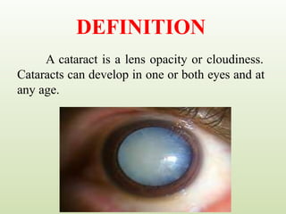 DEFINITION
A cataract is a lens opacity or cloudiness.
Cataracts can develop in one or both eyes and at
any age.
 