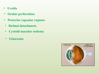 • Uveitis
• Ocular perforation.
• Posterior capsular rupture
• Retinal detachment.
• Cystoid macular oedema
• Glaucoma
 