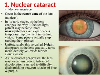 1. Nuclear cataract
• Most common type
• Occur in the center zone of the lens
(nucleus).
• In its early stages, as the lens
changes the way it focuses light,
patient may become more
nearsighted or even experience a
temporary improvement in reading
vision. Some people actually stop
needing their glasses.
• Unfortunately, this so-called 2n
d
sight
disappears as the lens gradually turns
more densely yellow & further
clouds vision.
• As the cataract progresses, the lens
may even turn brown. Advanced
discoloration can lead to difficulty
distinguishing between shades of blue
& purple.
 
