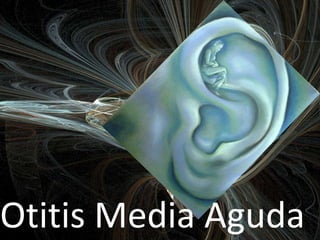 Otitis Media Aguda
 