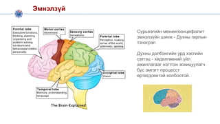 Эмнэлзүй
Сүрьеэгийн менингоэнцефалит
эмнэлзүйн шинж - Духны гарлын
тэнэгрэл
Духны дэлбэнгийн урд хэсгийн
сэтгэц - хөдөлгөөний үйл
ажиллагааг нэгтгэн зохицуулагч
бүс эмгэгт процесст
өртөгдсөнтэй холбоотой.
 