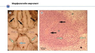 Морфологийн өөрчлөлт
 