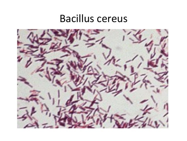 bacillus cereus gram stain