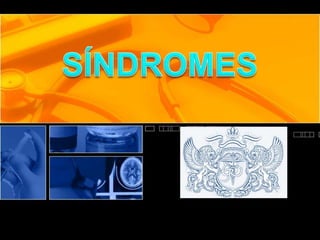 SÍNDROMES
