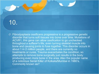 10.
Fibrodysplasia ossificans progressiva is a progressive genetic
disorder that turns soft tissues into bone over time. Mutations of
ACVR1, this gene can allow ossification to go unchecked
throughout a sufferer's life, even turning skeletal muscle into
bone and causing joints to fuse together. This disorder occurs in
about 1 in 2 million people, and there are currently no
treatments or cures. Trauma exacerbates the condition, so
attempts to remove bone surgically just results in the body
producing even more bone in the area. Also the popular name
of a notorious Serial Killer of Kolkata/Mumbai in 1980’s,
Commonly known as?
 