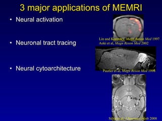 3 major applications of MEMRI <ul><li>Neural activation </li></ul><ul><li>Neuronal tract tracing </li></ul><ul><li>Neural ...