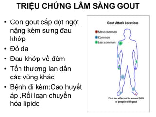 TRIỆU CHỨNG LÂM SÀNG GOUT
• Cơn gout cấp đột ngột
nặng kèm sưng đau
khớp
• Đỏ da
• Đau khớp về đêm
• Tổn thương lan dần
các vùng khác
• Bệnh đi kèm:Cao huyết
áp ,Rối loạn chuyển
hóa lipide
 