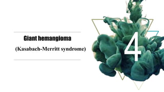 Giant hemangioma
(Kasabach-Merritt syndrome)
 