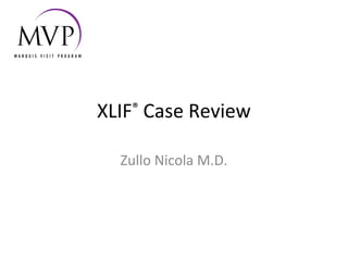 XLIF®
Case Review
Zullo Nicola M.D.
 