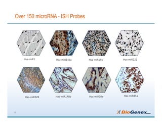 Over 150 microRNA - ISH Probes
Has-miR148b	
Has-miR222	Hsa-miR155	Hsa-miR1	 Hsa-miR146a	
Has-miR328	 Has-miR30e	 Has-miR451	
14
 