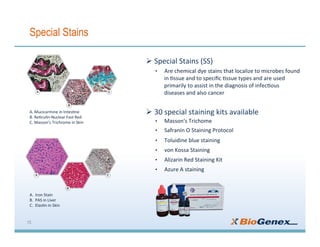 Special Stains
Ø 	Special	Stains	(SS)	
•  Are	chemical	dye	stains	that	localize	to	microbes	found	
in	3ssue	and	to	speciﬁc	3ssue	types	and	are	used	
primarily	to	assist	in	the	diagnosis	of	infec3ous	
diseases	and	also	cancer	
Ø 	30	special	staining	kits	available	
•  Masson's	Trichome		
•  Safranin	O	Staining	Protocol		
•  Toluidine	blue	staining		
•  von	Kossa	Staining			
•  Alizarin	Red	Staining	Kit	
•  Azure	A	staining		
A.	Mucicarmine	in	Intes3ne			
B.	Re3culin-Nuclear	Fast	Red	
C.	Masson’s	Trichrome	in	Skin	
A.		Iron	Stain			
B.		PAS	in	Liver			
C.		Elas3n	in	Skin	
15
 
