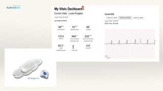 OnIntensiv
Current Vitals : Lucien Engelen
 