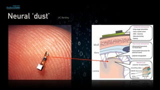 Neural ‘dust’ UC Berkley
 