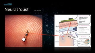 Neural ‘dust’ UC Berkley
 
