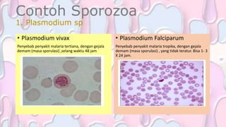Contoh Sporozoa
1. Plasmodium sp
• Plasmodium Falciparum
Penyebab penyakit malaria tropika, dengan gejala
demam (masa sporulasi) , yang tidak teratur. Bisa 1- 3
X 24 jam.
• Plasmodium vivax
Penyebab penyakit malaria tertiana, dengan gejala
demam (masa sporulasi) ,selang waktu 48 jam
 