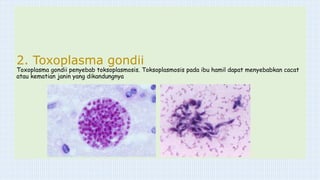 2. Toxoplasma gondii
Toxoplasma gondii penyebab toksoplasmosis. Toksoplasmosis pada ibu hamil dapat menyebabkan cacat
atau kematian janin yang dikandungnya
 