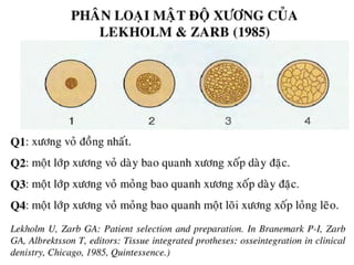 xương ổ răng.pdf