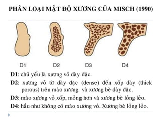 xương ổ răng.pdf