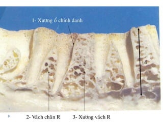 xương ổ răng.pdf
