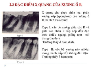 xương ổ răng.pdf