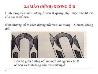 xương ổ răng.pdf