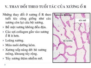 xương ổ răng.pdf