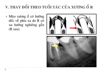 xương ổ răng.pdf