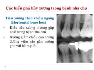 xương ổ răng.pdf