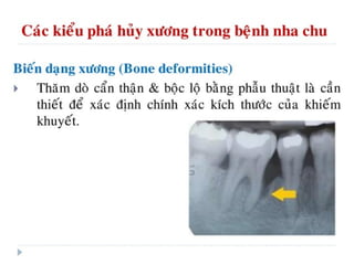 xương ổ răng.pdf