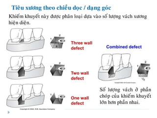 xương ổ răng.pdf