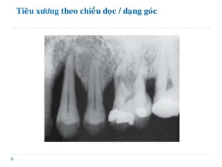 xương ổ răng.pdf