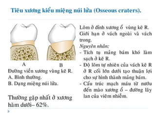 xương ổ răng.pdf