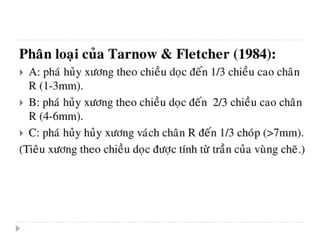 xương ổ răng.pdf