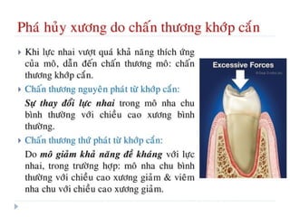 xương ổ răng.pdf