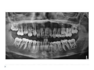 xương ổ răng.pdf