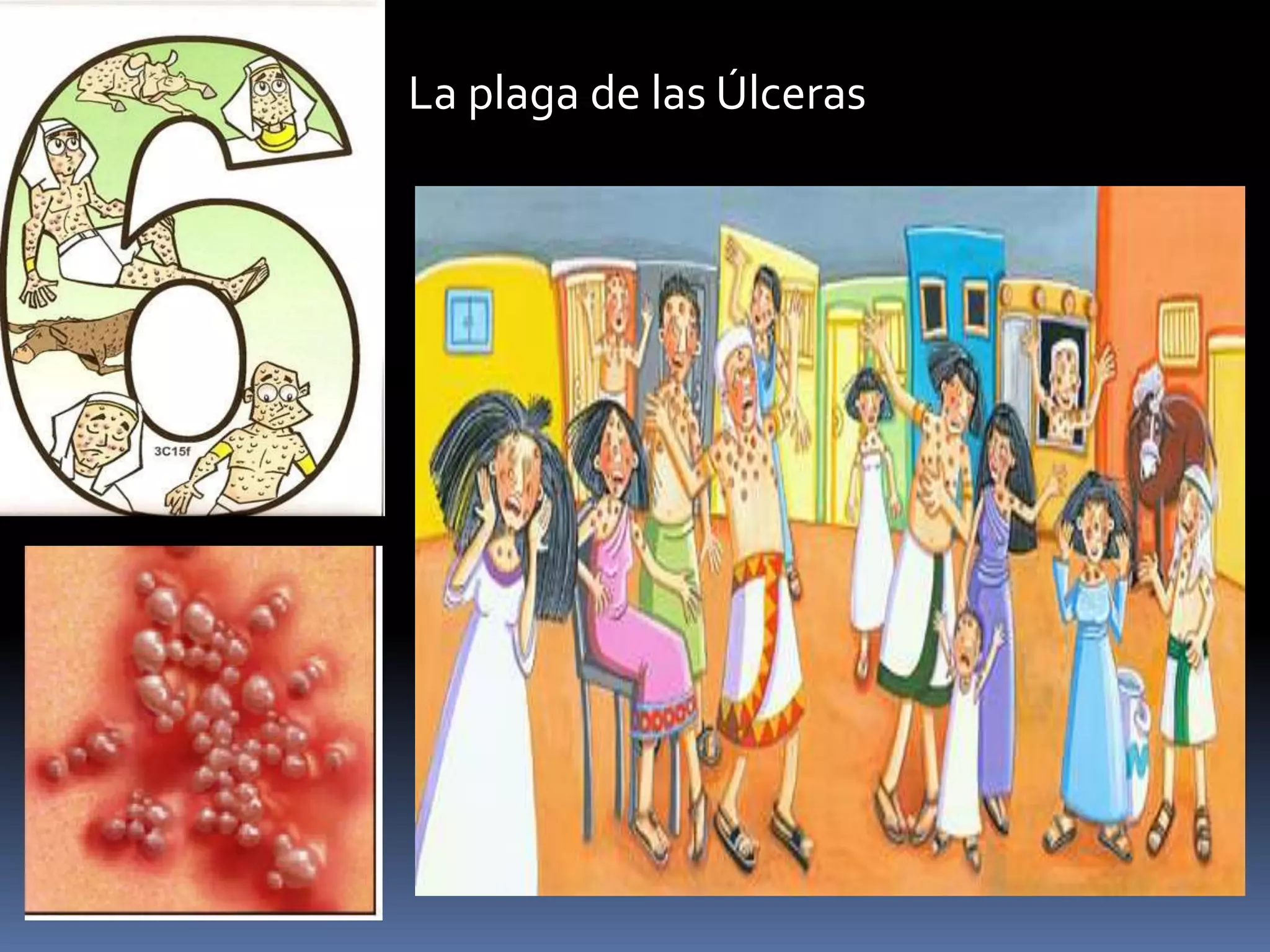 La plaga de las Úlceras