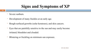 09/20/2025
12
Signs and Symptoms of XP
 Severe sunburn.
 Development of many freckles at an early age.
 Rough-surfaced growths (solar keratoses), and skin cancers.
 Eyes that are painfully sensitive to the sun and may easily become
irritated, bloodshot and clouded.
 Blistering or freckling on minimum sun exposure.
 