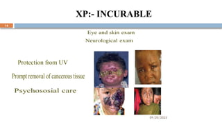 09/20/2025
14
XP:- INCURABLE
Protection from UV
 