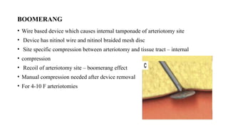 BOOMERANG
• Wire based device which causes internal tamponade of arteriotomy site
• Device has nitinol wire and nitinol braided mesh disc
• Site specific compression between arteriotomy and tissue tract – internal
• compression
• Recoil of arteriotomy site – boomerang effect
• Manual compression needed after device removal
• For 4-10 F arteriotomies
 