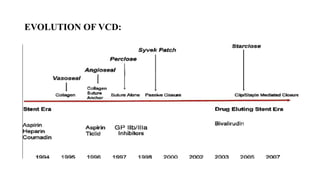 EVOLUTION OF VCD:
 